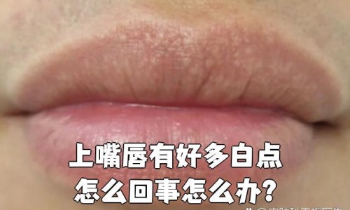 减肥期间暴食了怎么补救专区_减肥期间暴食怎么办专区_减肥期间暴食网